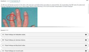 NR509 Week 8 Final Exam